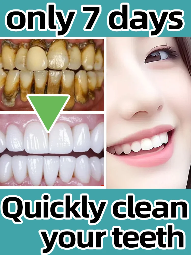 Blanqueamiento Dental, elimina las manchas de placa, cálculo Dental, higiene bucal, limpieza, mal aliento fresco, productos para el cuidado de los dientes