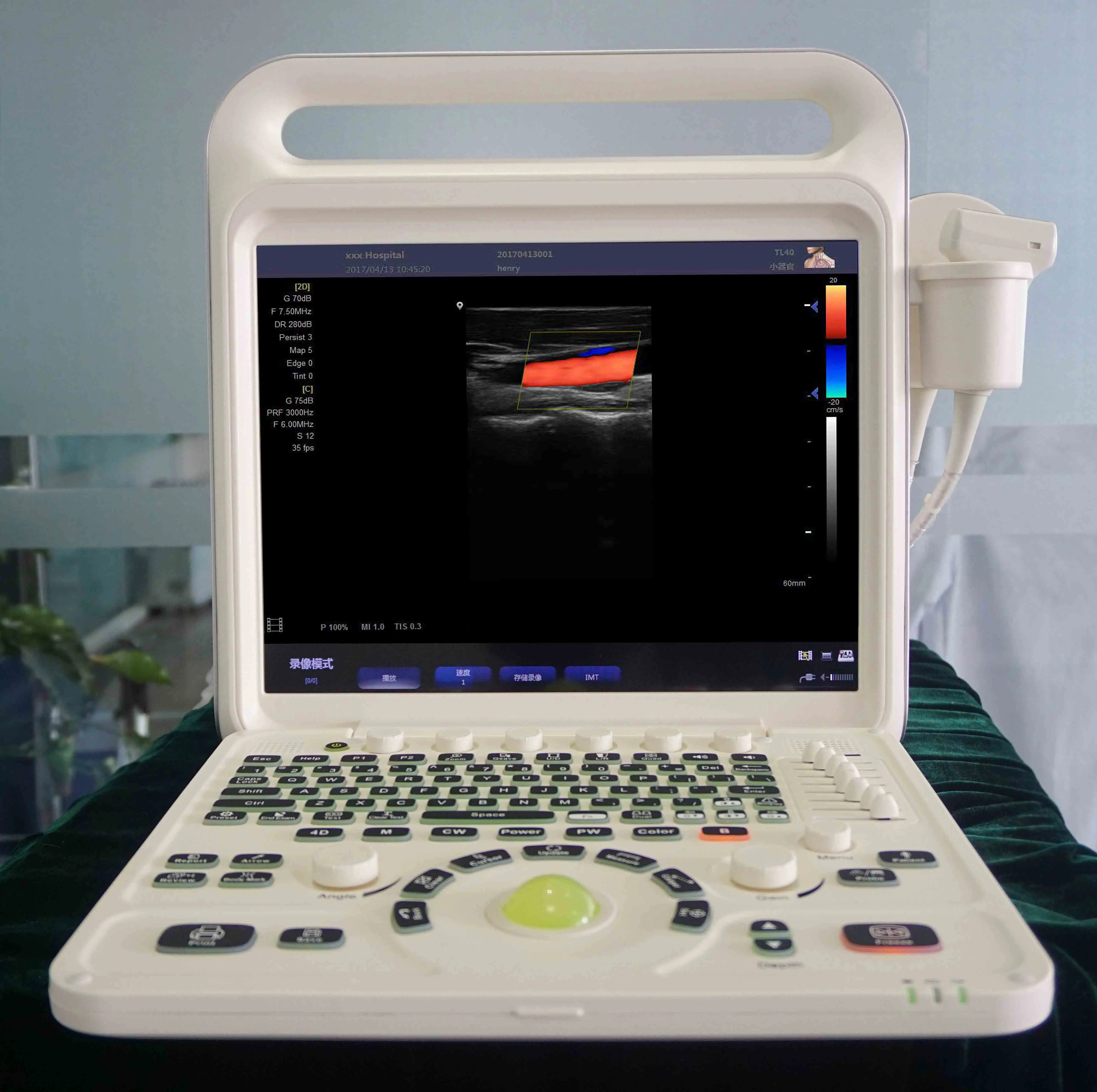 LTUB63 Medical Ultrasound Instrument Portable Clinical Medical Notebook Computer 4D 3D Color Ultrasound Machine