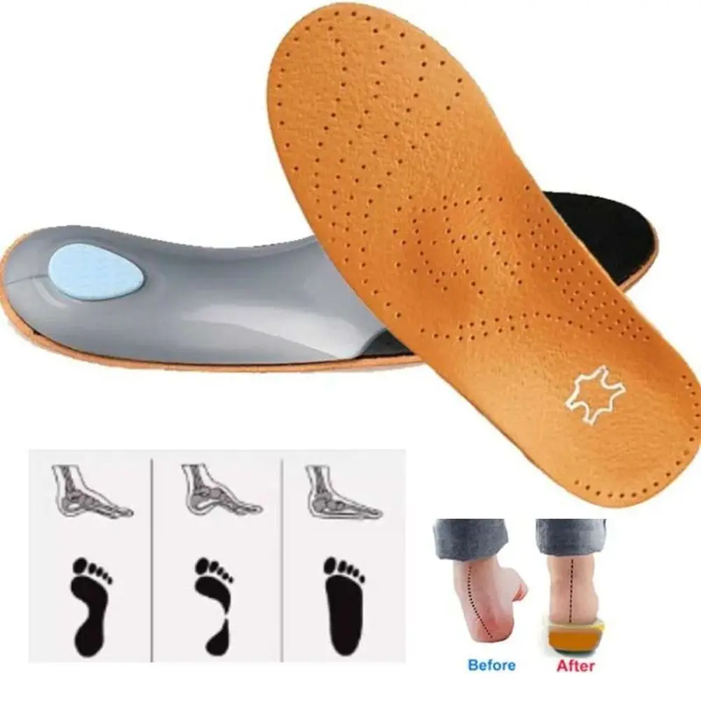 PU Leather Orthopedic Insoles O/X Leg Corrected Foot Pad Sports Shoe Pad Orthotic Flat Foot Health Foot Care Supplies Men