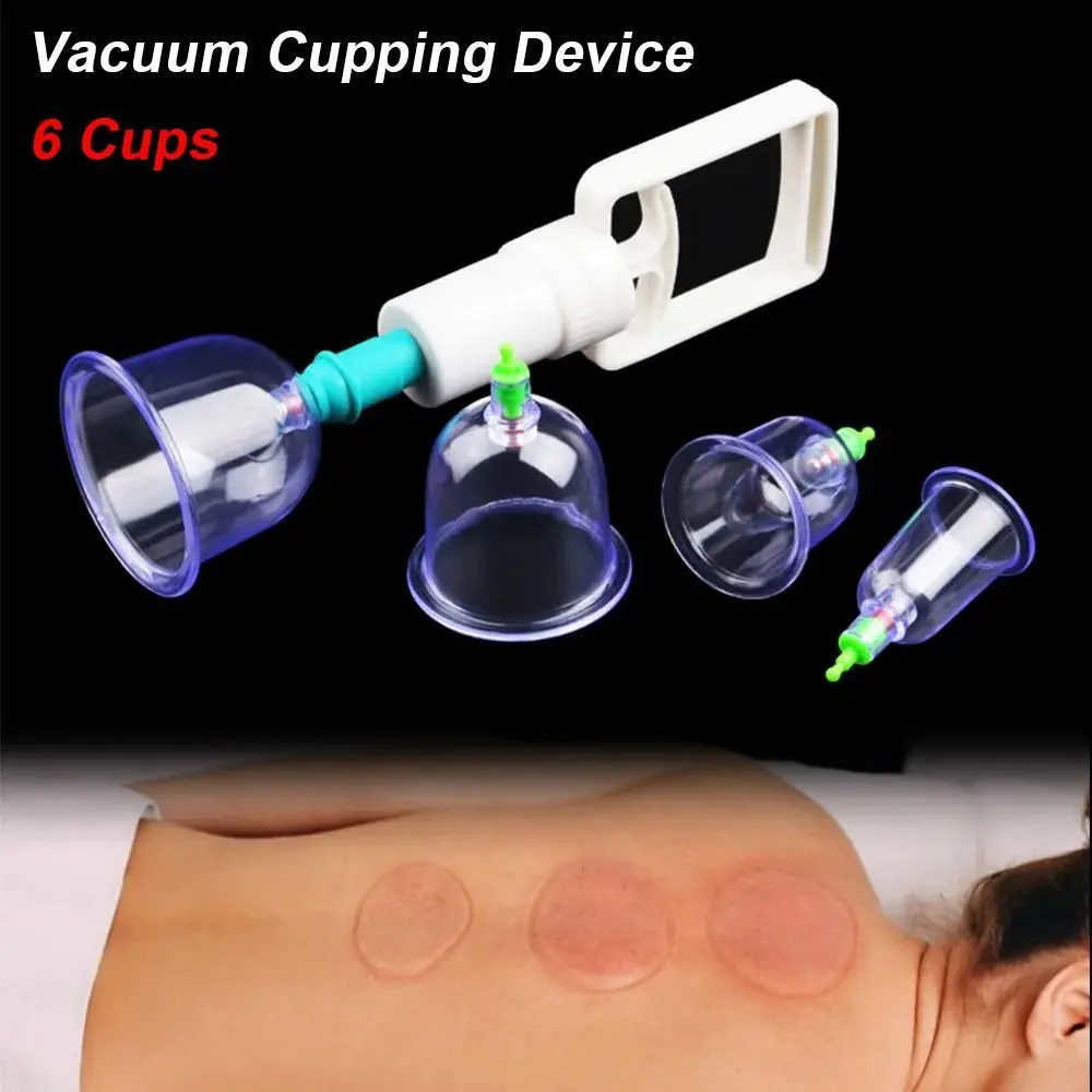 8Pcs/Set Anti-cellulite Vacuum Cupping Cans Dry Wet Type Body Therapy Massage Cupping Device Non-Glass 6 Cups