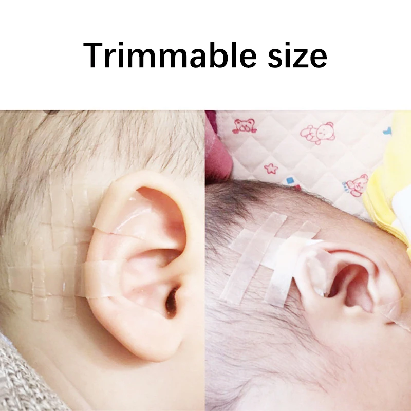 1 Roll Baby Ear Corrector Infant Protruding Ears Correction Silicone Kids Ear Aesthetic Correctors Patch Sticker Ear Care