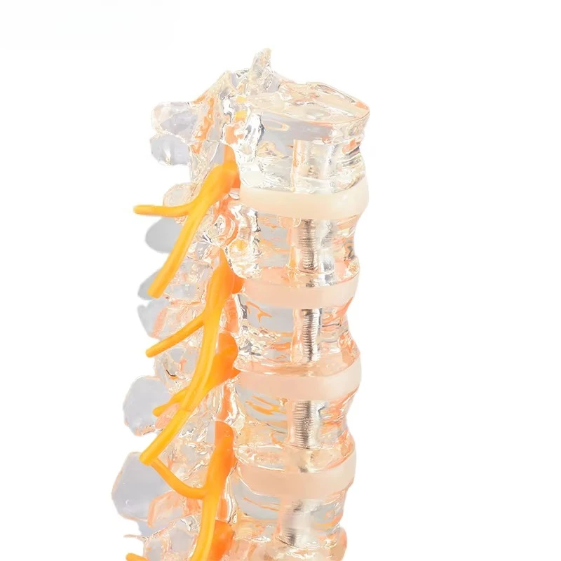 Clear Human Spine Model Human Lumbar Spine Model with Sacrum, Spinal Nerves and Herniation Disc