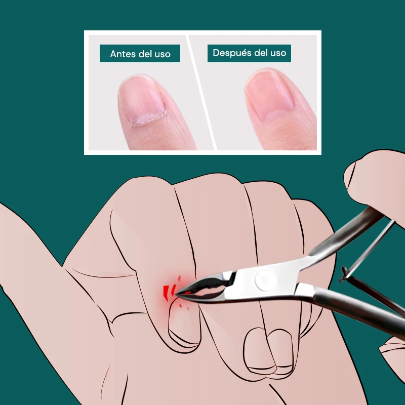 MR.GREEN Cortacutículas de Manicura Tijeras Cortaúñas Recortador Eliminador de Piel Muerta Pedicura Acero Inoxidable 2