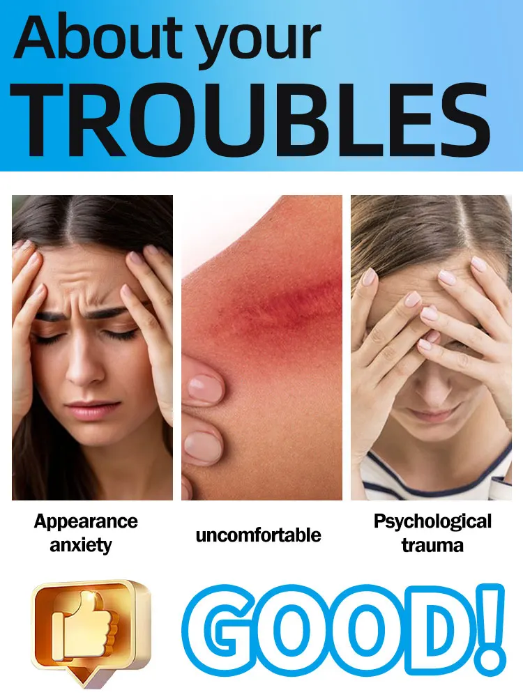 2025 new product The latest scar technology