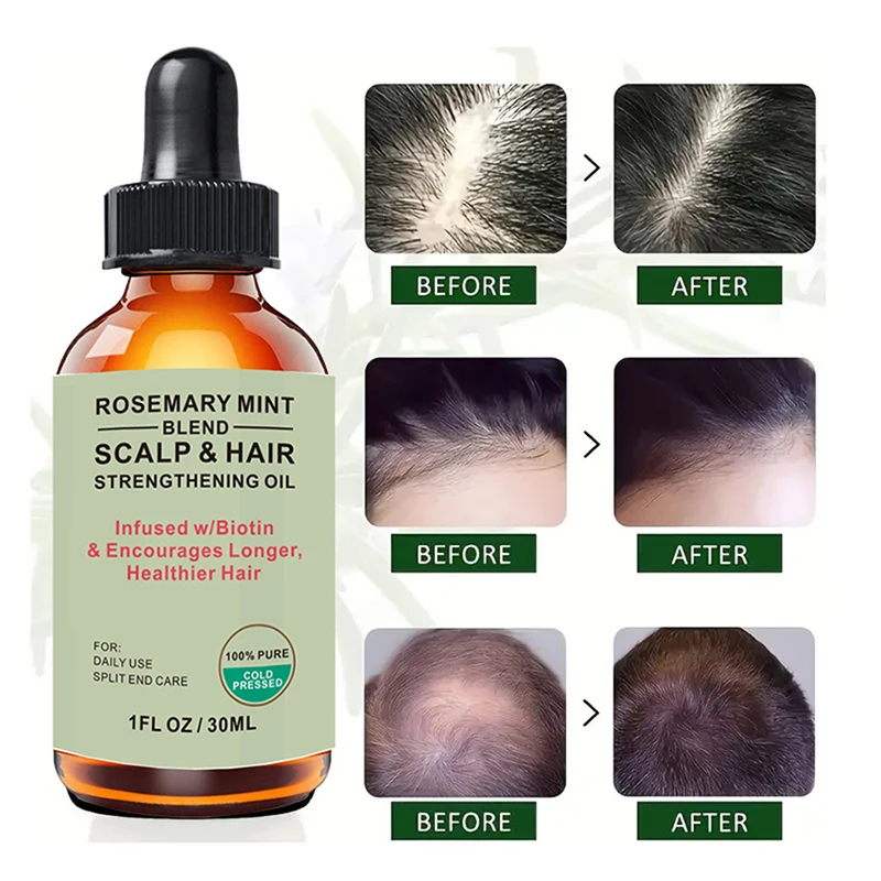 Hair Growth Essential Oil Sclap and Hair Strenghtening Oil Nourishing Treatment For Split Ends Dry Organics Hair Care Oil