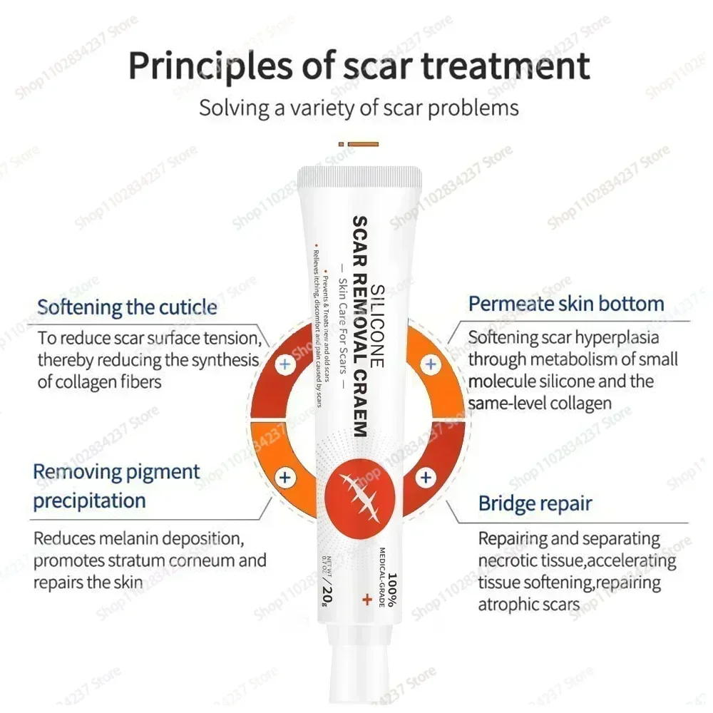 Eliminación rápida de cicatrices, eliminación de manchas de acné, tratamiento de estrías, quemaduras, cicatrices quirúrgicas, suavizante, blanqueamiento, cuidado de pigmentación, gran oferta