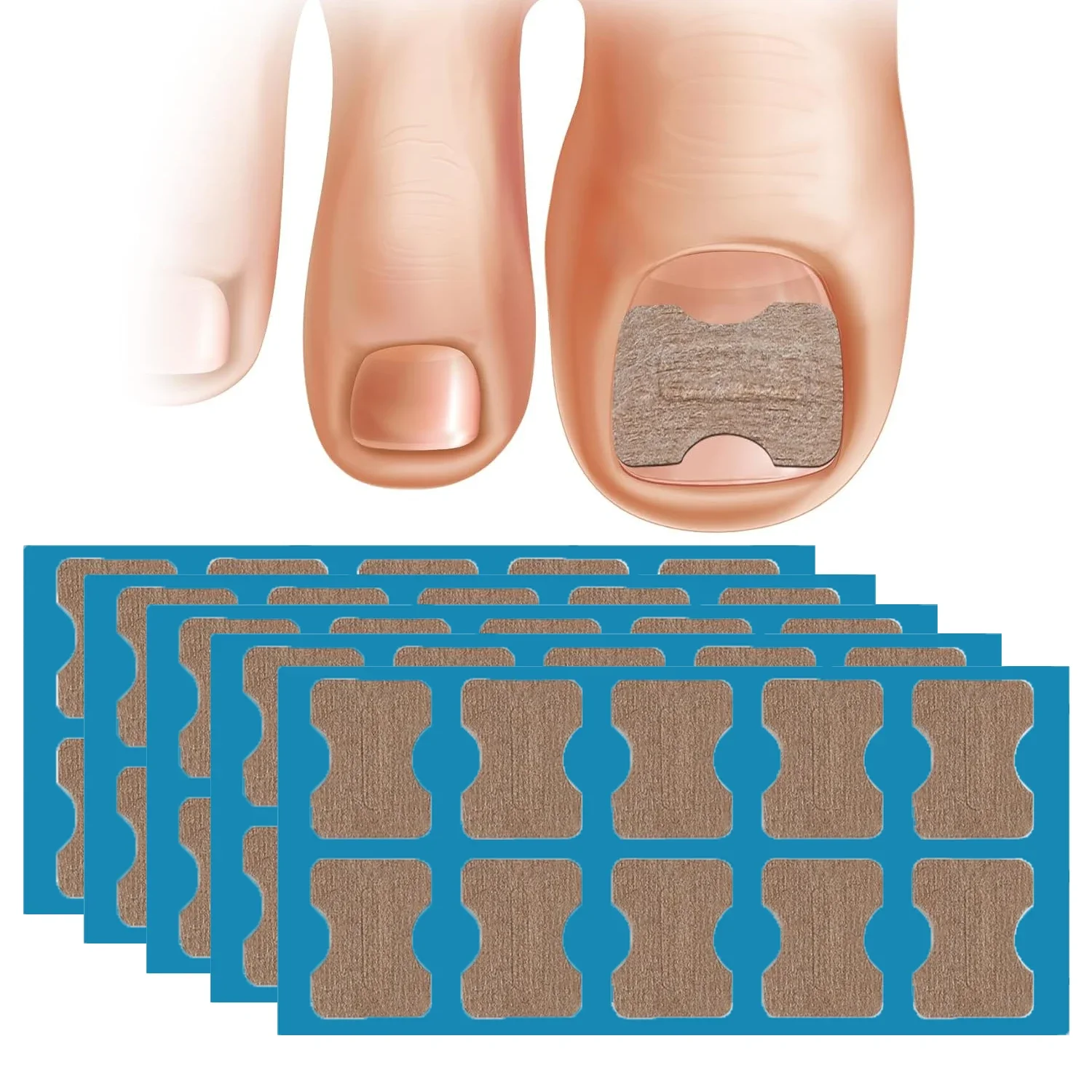 50/100pcs Nail Correction Stickers Ingrown Toenail Corrector Patches Paronychia Treatment Recover Corrector Pedicure Tools