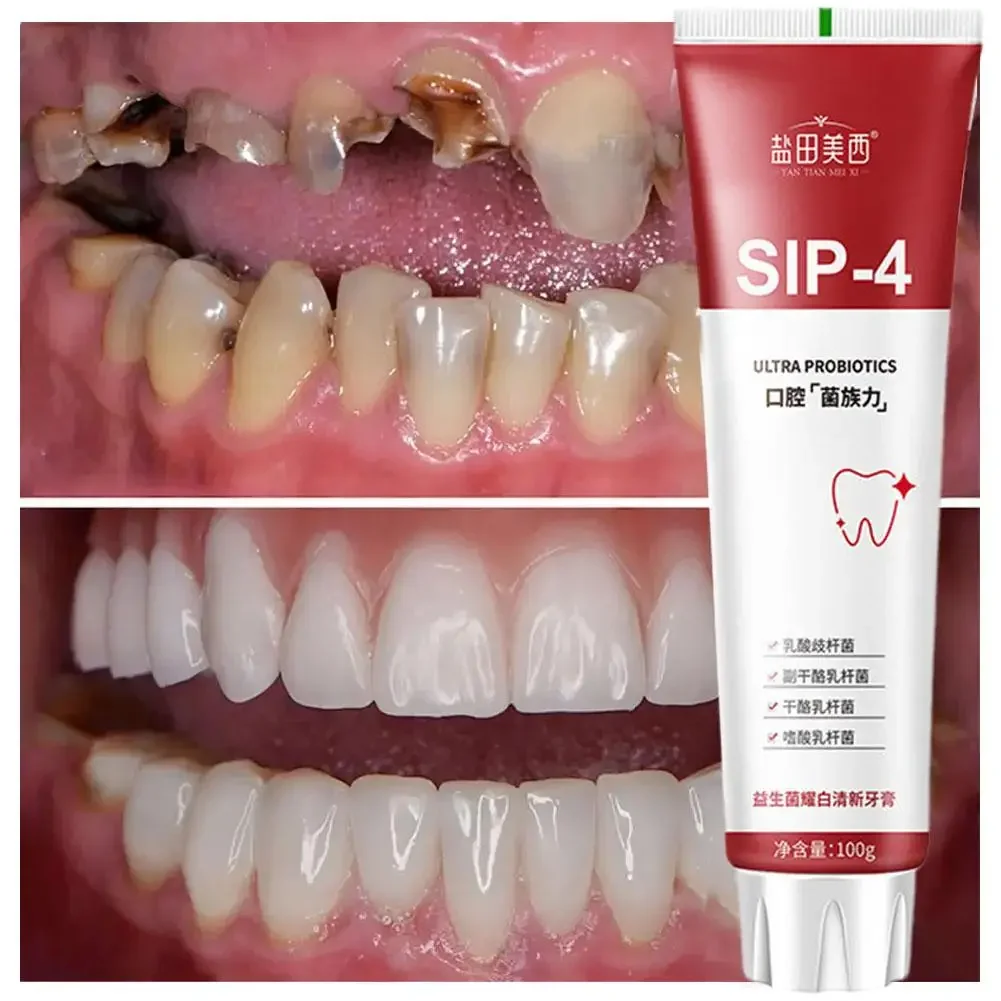 5 pz Sip-4 dentifricio sbiancante probiotico rimozione macchie dentifricio probiotico alito fresco sbiancamento dei denti schiarente dente passato