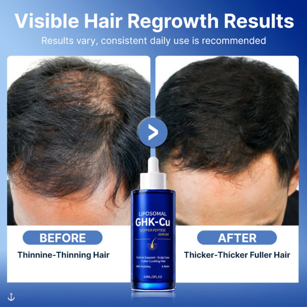 60ml Ghk-Cu Copper Peptide Liposomal Serum Anti Hair Loss Scalp Care Quick Absorb Relieve Hair Loss Hair Essence