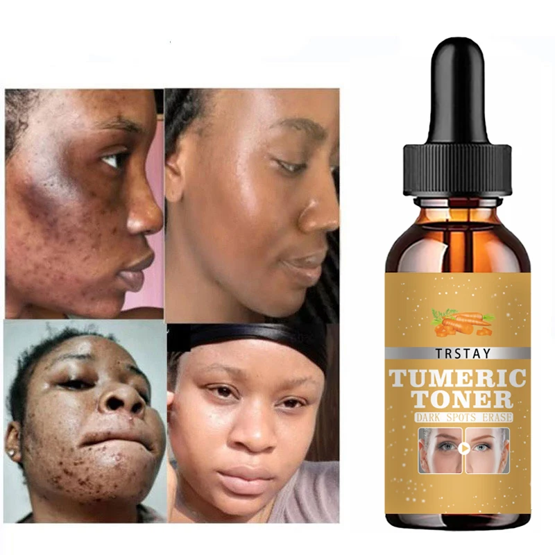 Turmeric Lemon Skin Glow Face Serum Acne Dark Spot Whitening Black Patches Melasma Corrector Brightening Essential Oil Skin Care