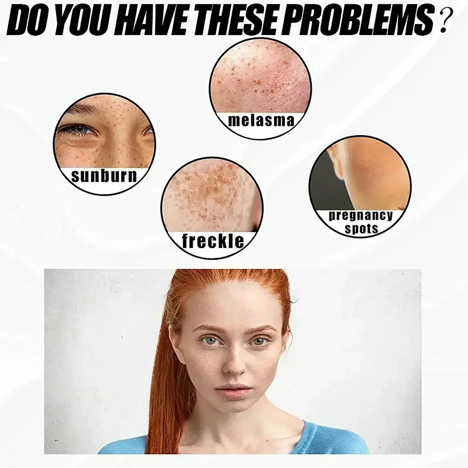Whitening Freckle Cream Freckles Brighten Facial Skin Firming Reduce Melanin Lighten Dark Skin Removal Dark Spots Fades sun spot