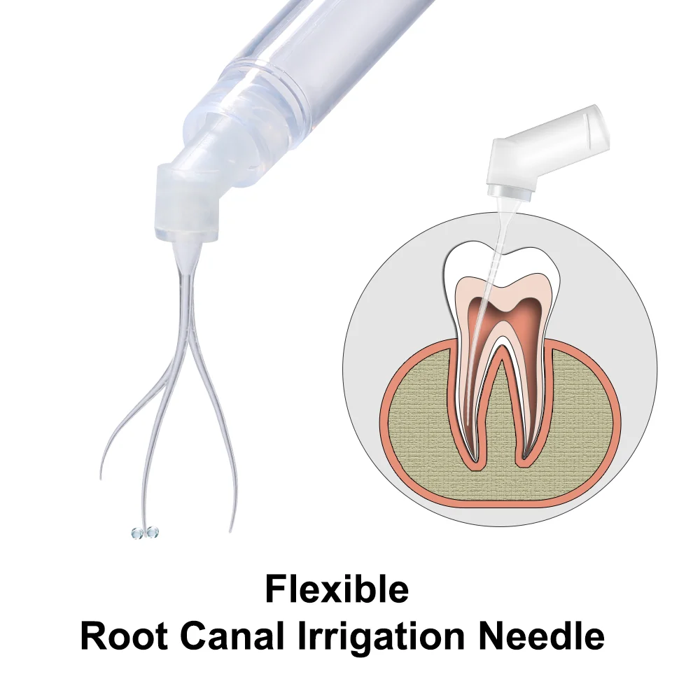 AI-Endo-2S Dental Endo Syringe Irrigation Root Canal Needle Tips Washing 60 degree Elbow 4% Tip Taper with Two Outlets 30pcs/box