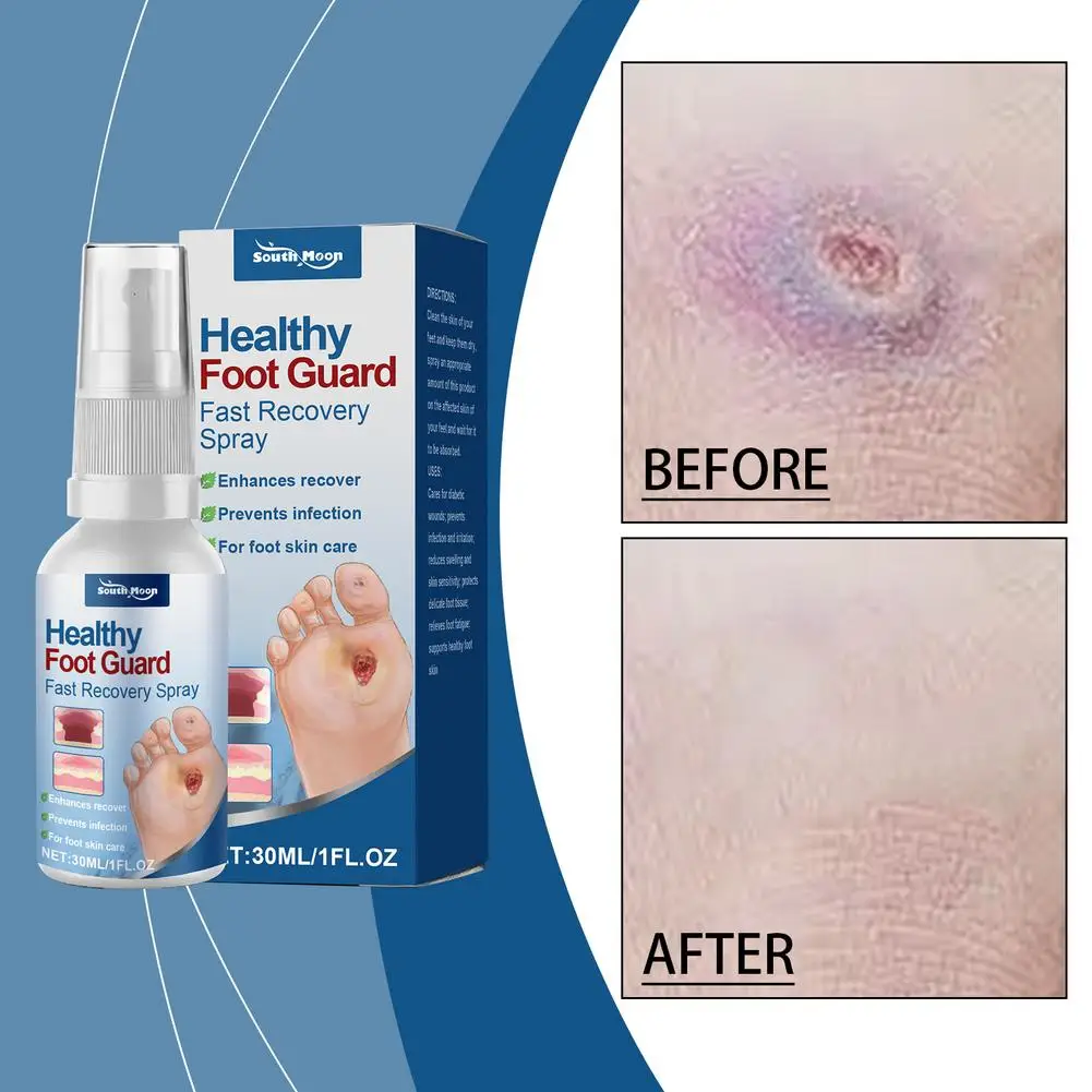 Semprotan Penghilang Kalus Kaki dengan Cepat Melembutkan Pengelupasan Kulit Kapalan Kaki Membersihkan Kulit Mati Hidrasi Kulit Kaki Kutikula Perawatan Perbaikan X4A9