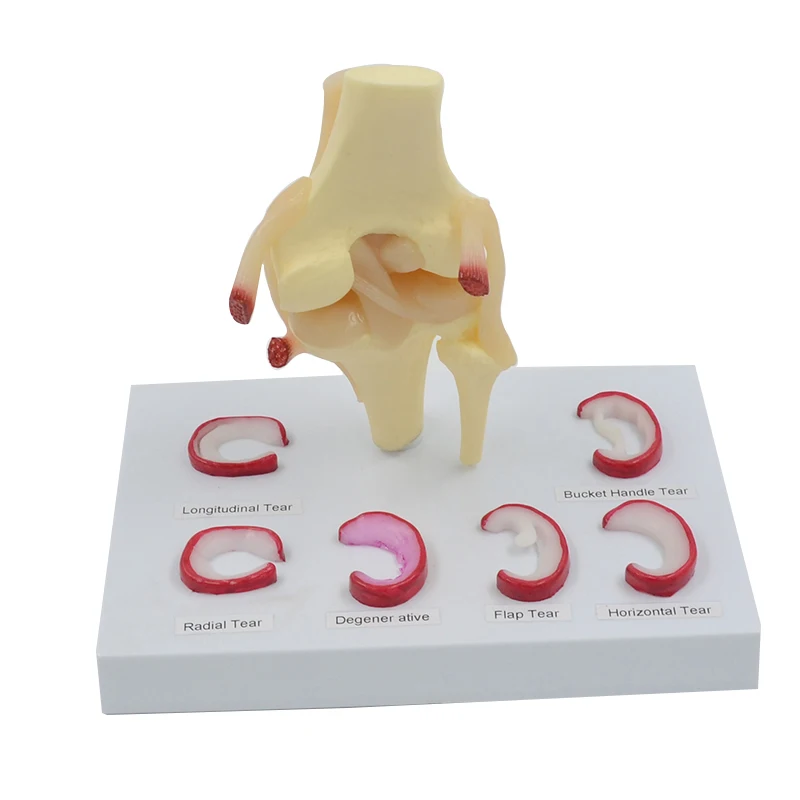 Meniscus Suture Model Life Size Human Demilune Menisci Medical Science Teaching Tool Anatomical Model