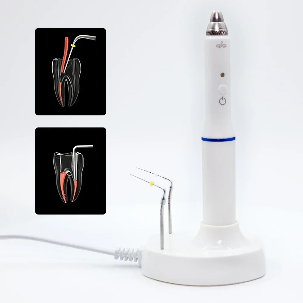 Enhance root canal therapy with dental cordless obturation system. Wireless heated pen + 2 tips. Quick 0.2 second rise.