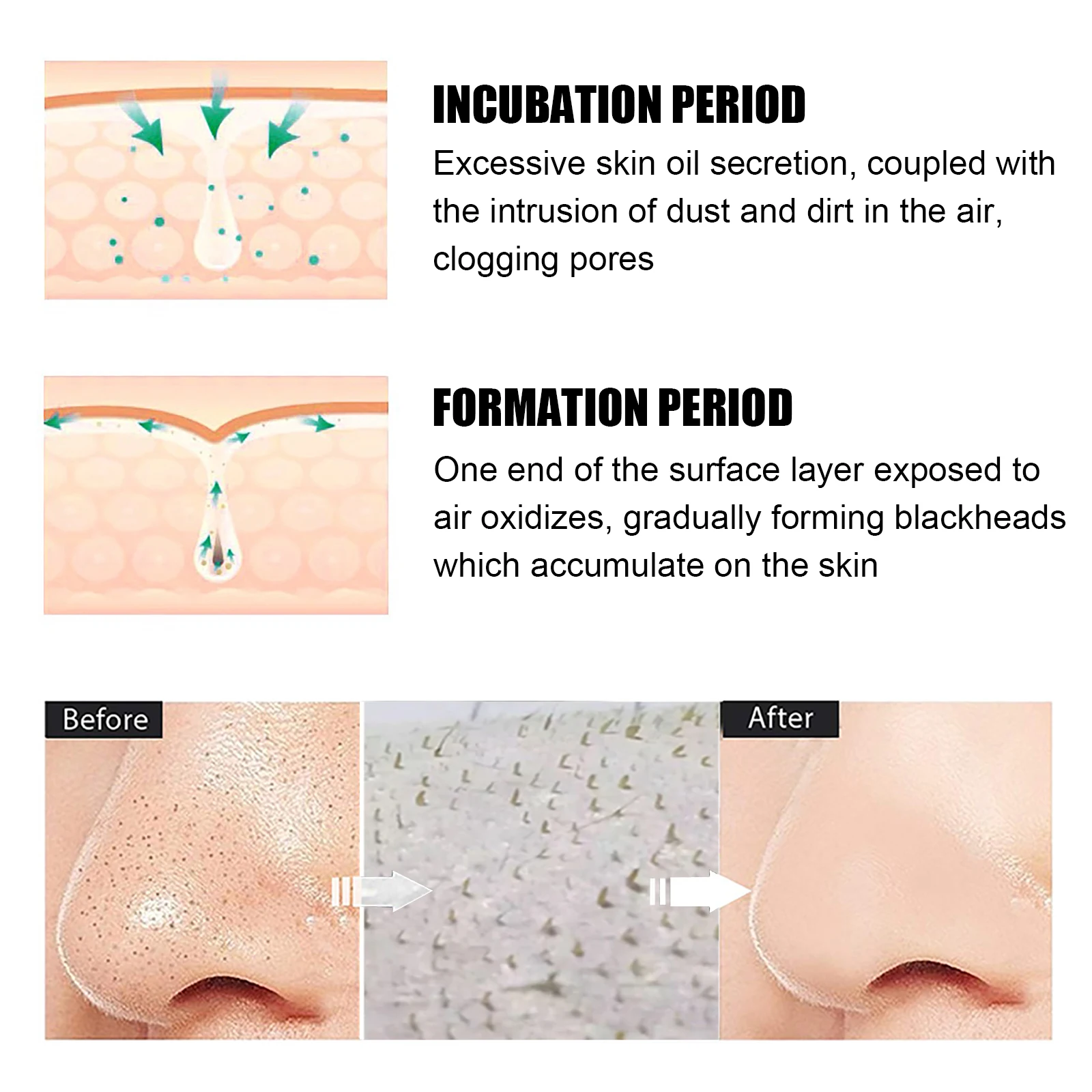 Nose Blackhead Remove Mask Paste Shrink And Clean Pores Nose Patch Oil Control Smoothing Purify Skin Natural Nose Care Balm Mask