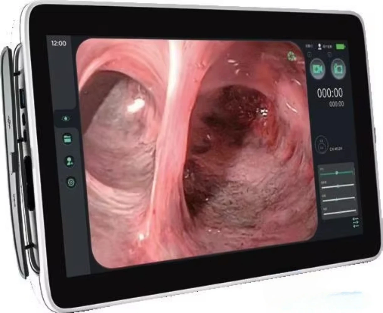 Practical Disposable Cholangioscopy Cost-effective & Ready Human Veterinary Flexible Fiber Cholangioscopy CH Series
