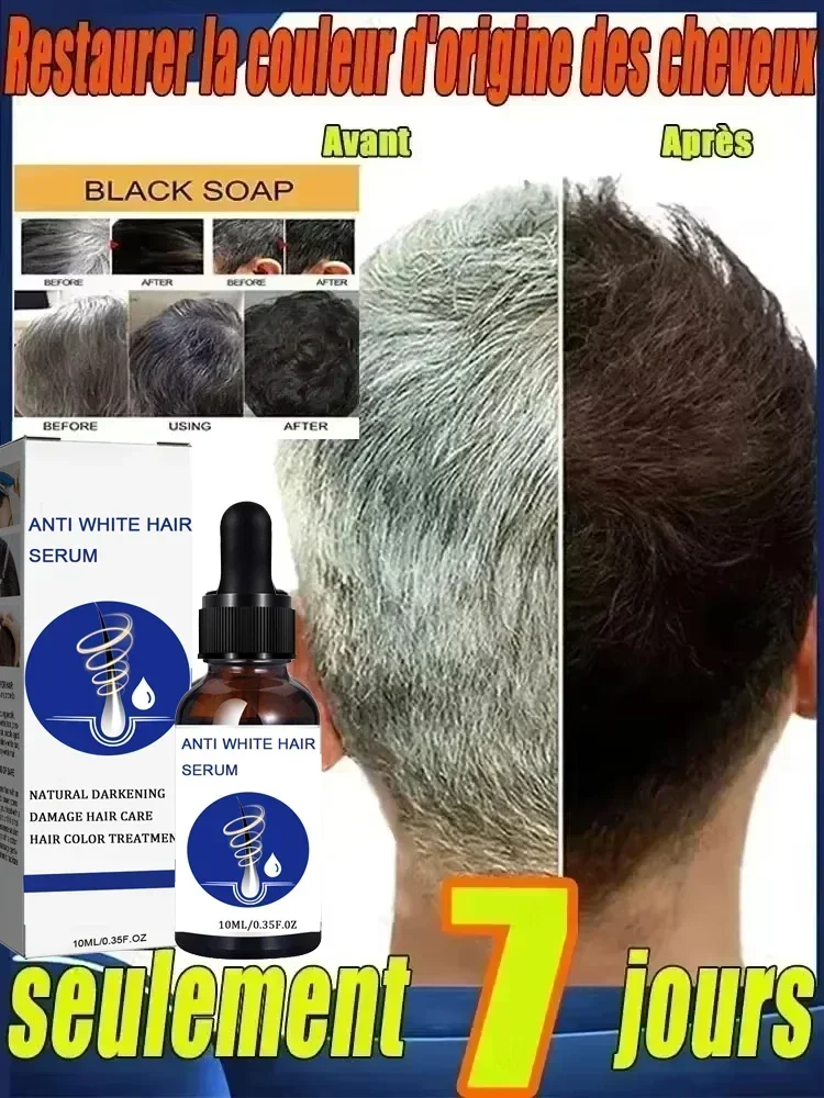 Turn white hair into black hair, remove gray hair in 7 days and restore natural and healthy hair color