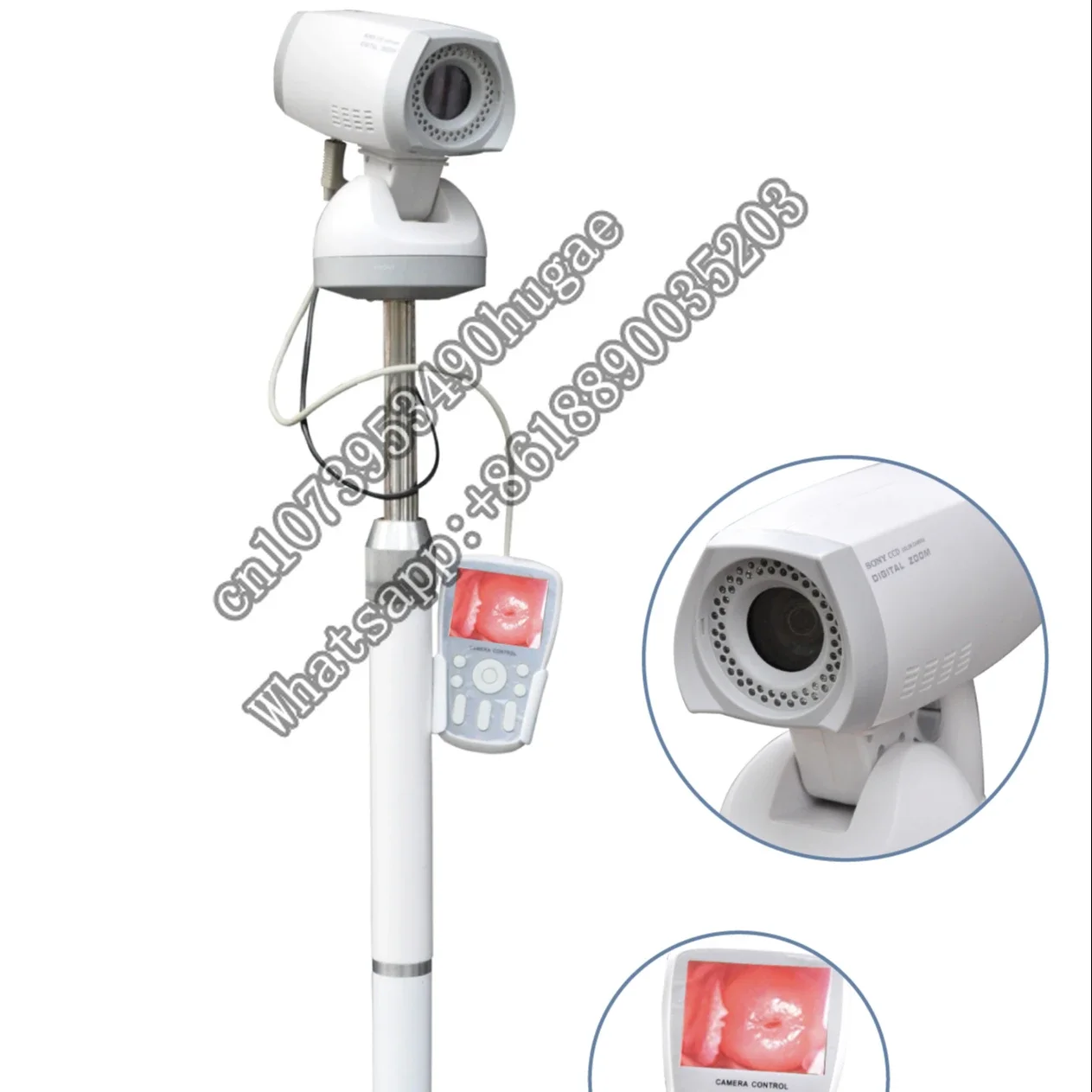 Video  With Tripod Gynecological Clinical Diagnostic Instruments