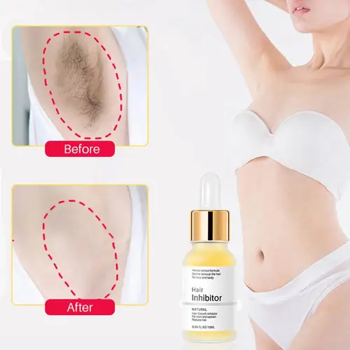 Imagen 2 del producto Suero de inhibición permanente del cabello, utensilio de depilación indoloro, axila, piernas, brazos, inhibidor, crema corporal depilatoria, cuidado para hombres y mujeres