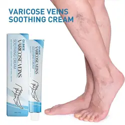 NEW High-end 20g Varicose Vein Repair Cream Phlebitis Worm Spider Legs Vessel Pain Treatment Soothing Reduce Swelling Cream