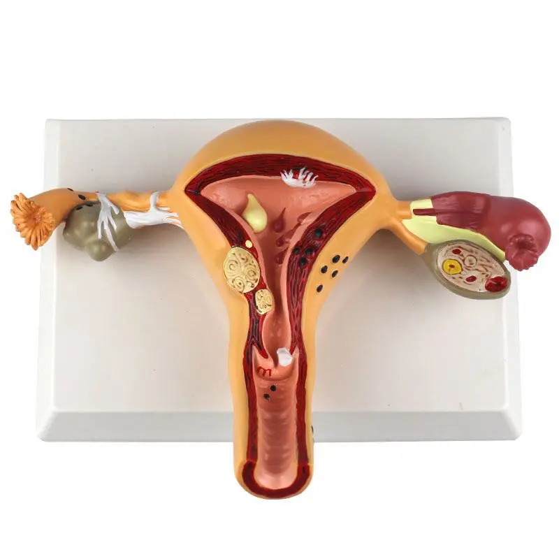 Human Model Female Reproductive Uterine Vaginal Ovarian Uterine Teaching Mold Pathology Popular Science Training Teaching Tool