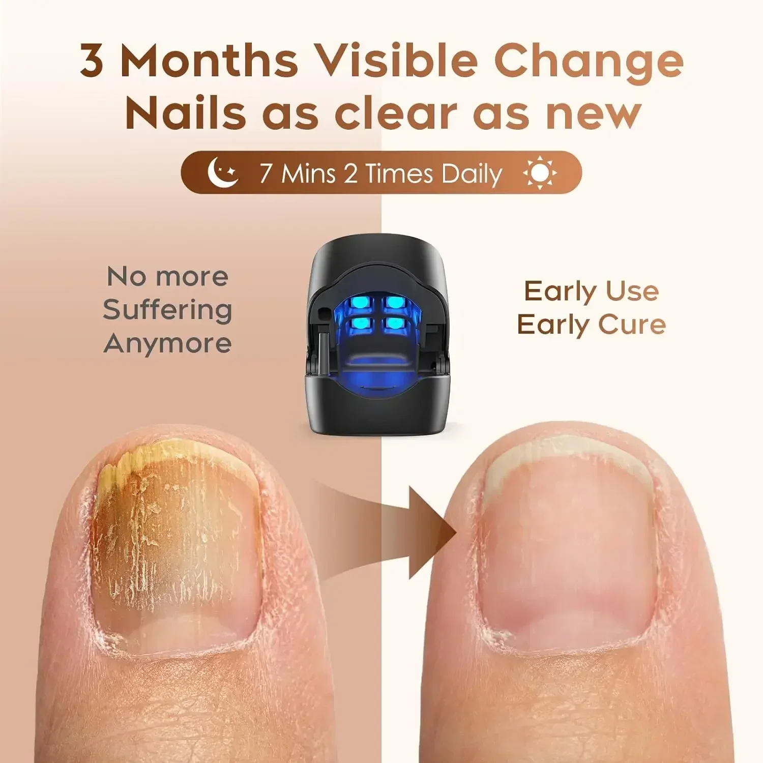 Nail Fungus Treatment Led Laser Device For Cleaning Onychomycosis USB Charge 905nm Infrared Light 470nm Blue Light Nail Care New