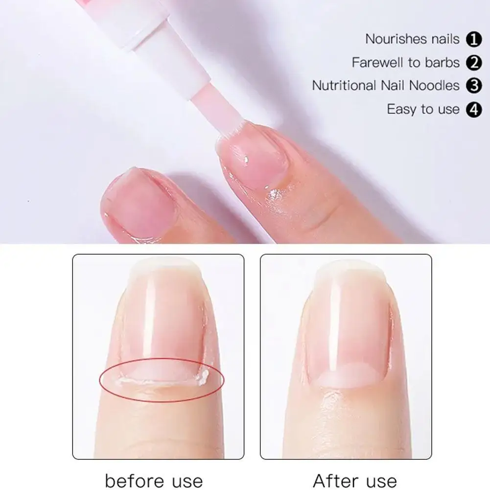 5Ml Voeding Olie Nagel Nagelriem Oliepen Voor Schoonheid Gezondheid Rand Pen Olie Voor Manicure Nailfinger Care Tools Vinger Nagel Trea J1u2