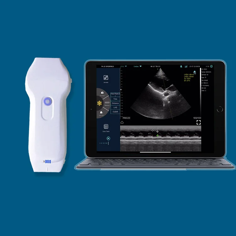 Cardiac Ultrasound Konted C10XL Double Head 3 in 1 Color Doppler Wireless Ultrasound Phased Array+Linear Probe