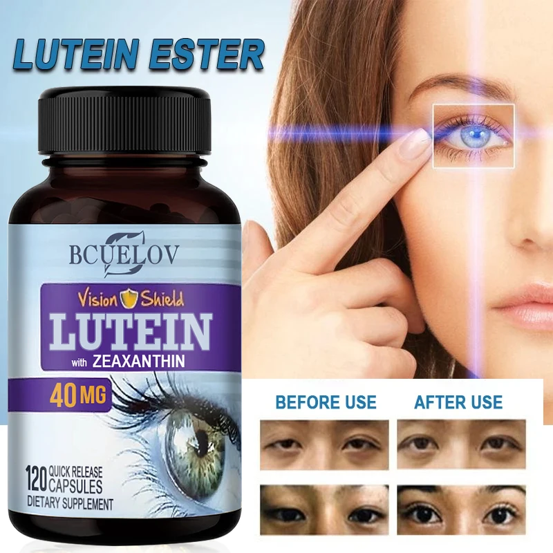 Bcuelov High Potency Lutein Capsules - Relieve Eye Fatigue, Dry Eye and Vision Health, Prevent Blue Light, Prevent Myopia