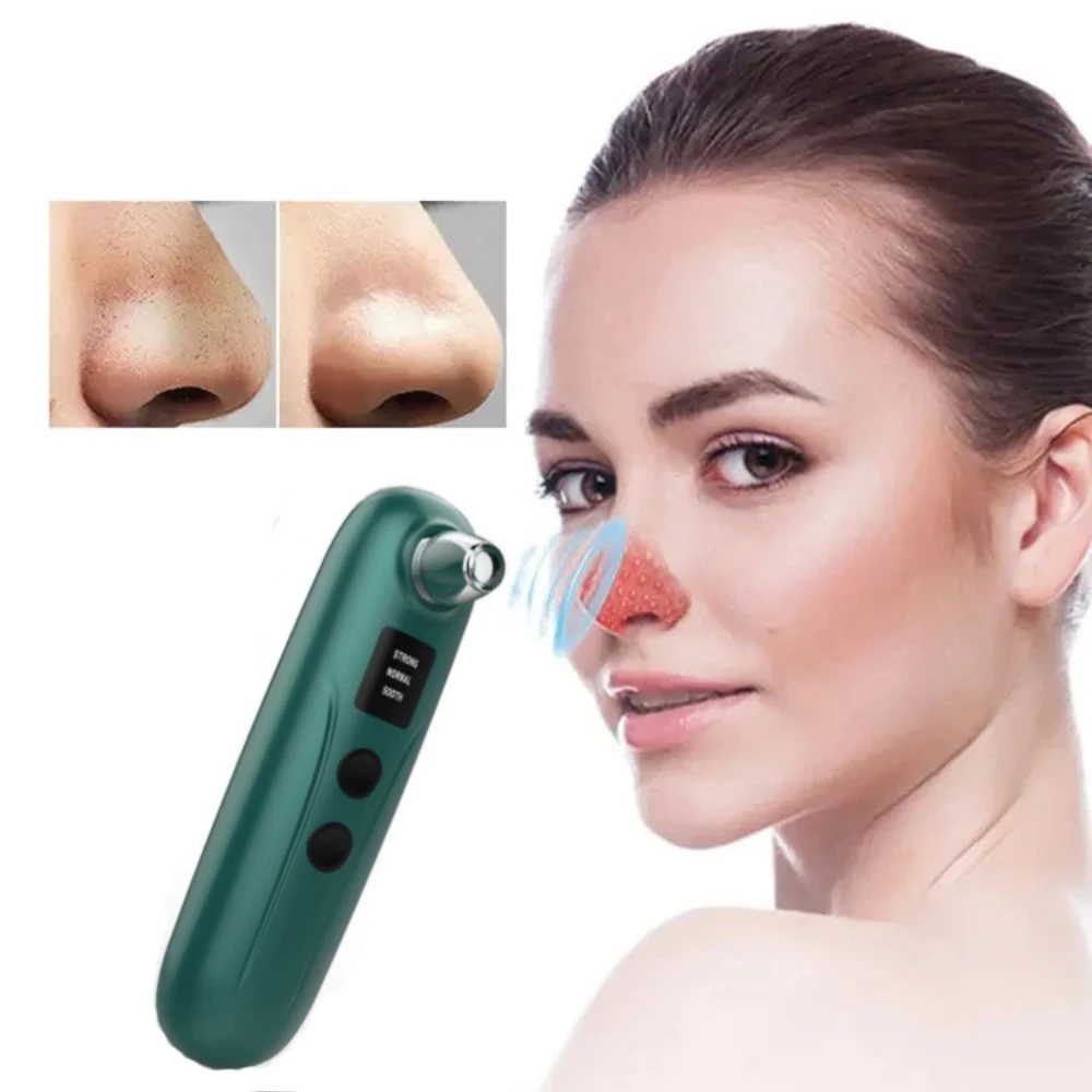 مصاصة الرؤوس السوداء الكهربائية، مزيل الرؤوس السوداء وحب الشباب، مستخرج الوجه الساخن، مزيل الرؤوس السوداء البصرية، آلة تنظيف عميق للوجه #4