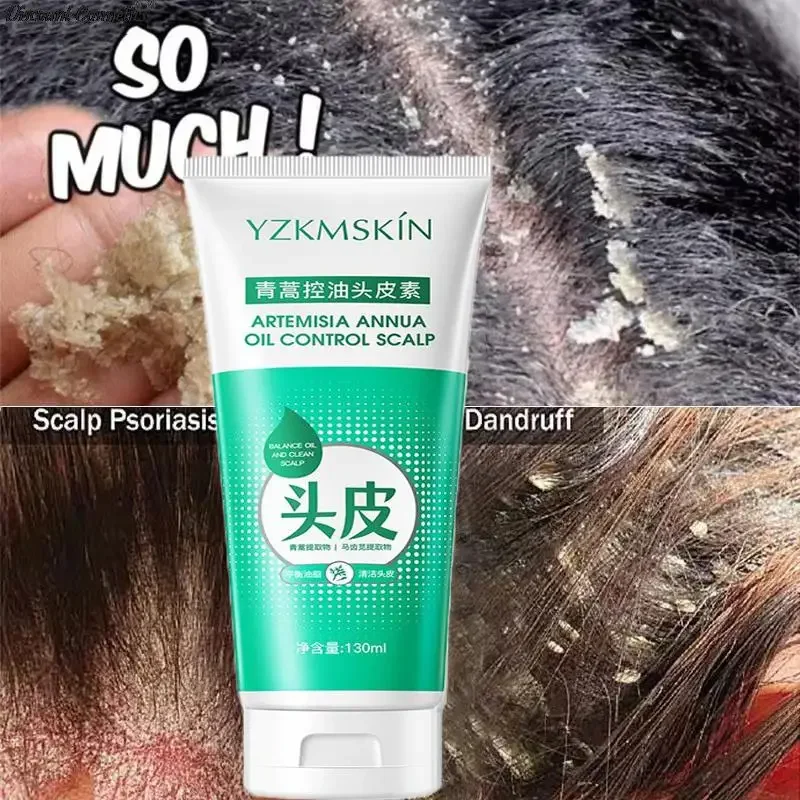 120ml Scalp Cleansing Shampoo Dandruff Seborrheic Follicles Antibacterial Anti-itching Mites Oil Control Psoriasis Removal Acne