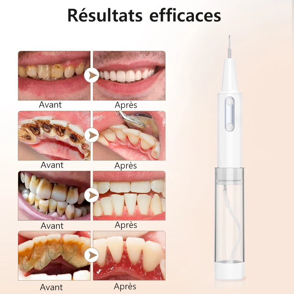 Dissolvant de Tartre Dentaire Ultrasonique, Irrigateur Oral, Hydropulseur, 2274