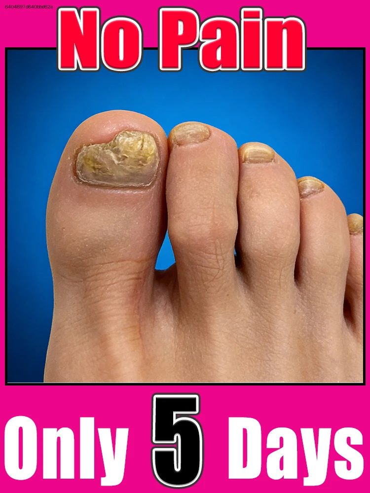 

2026 NEW Cleaning Nail Brush Tools Nail Art Manicureed Tool 2026 Hᴏᴛ Sᴀʟᴇ Fᴏᴏᴛ Cᴀʀᴇ Tᴏᴏʟs