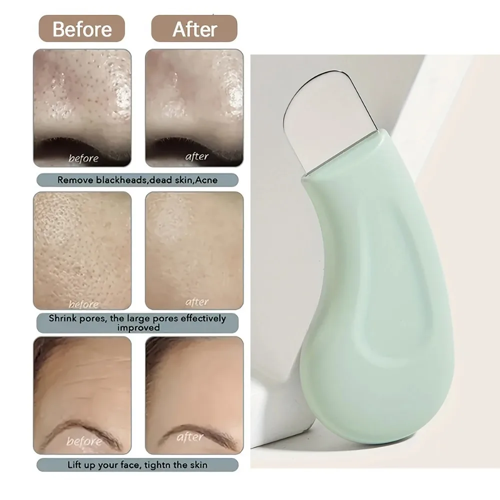 Nouvel outil d'élimination des points noirs, grattoir en Silicone pour le visage, nettoyage en profondeur de la peau, spatule pour le visage, dissolvant de points noirs du nez
