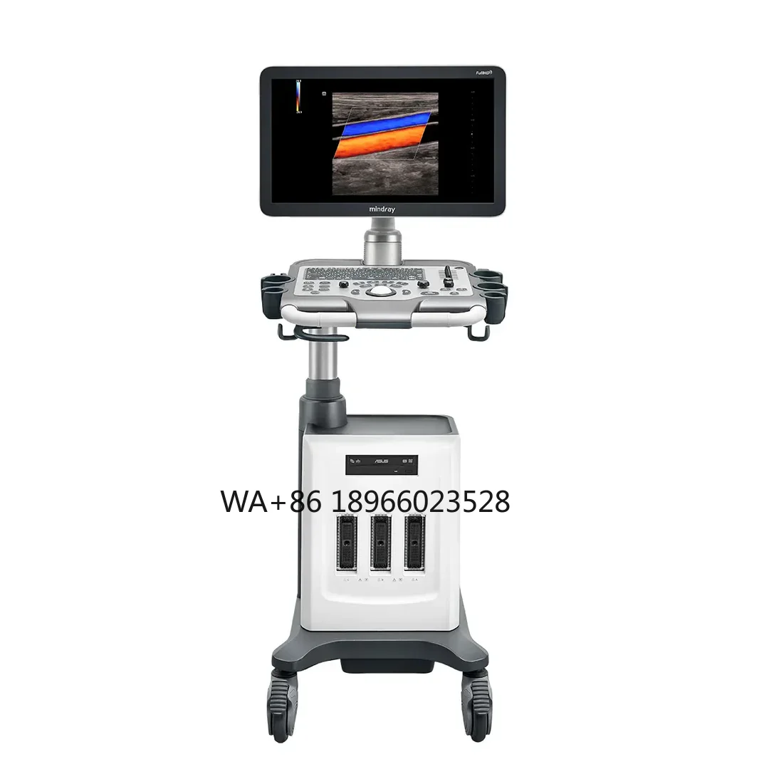 DC30 Doppler Color Ultrasound Primary Care Diagnostic Ultrasound 21.5 inch full high definition image 3D 4D Imaging Econ