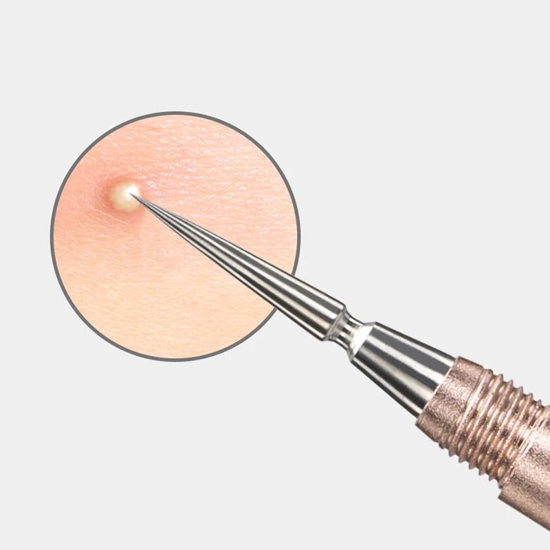 Extrator de cravo de aço inoxidável de cabeça dupla – para remoção de manchas de comedona e acne