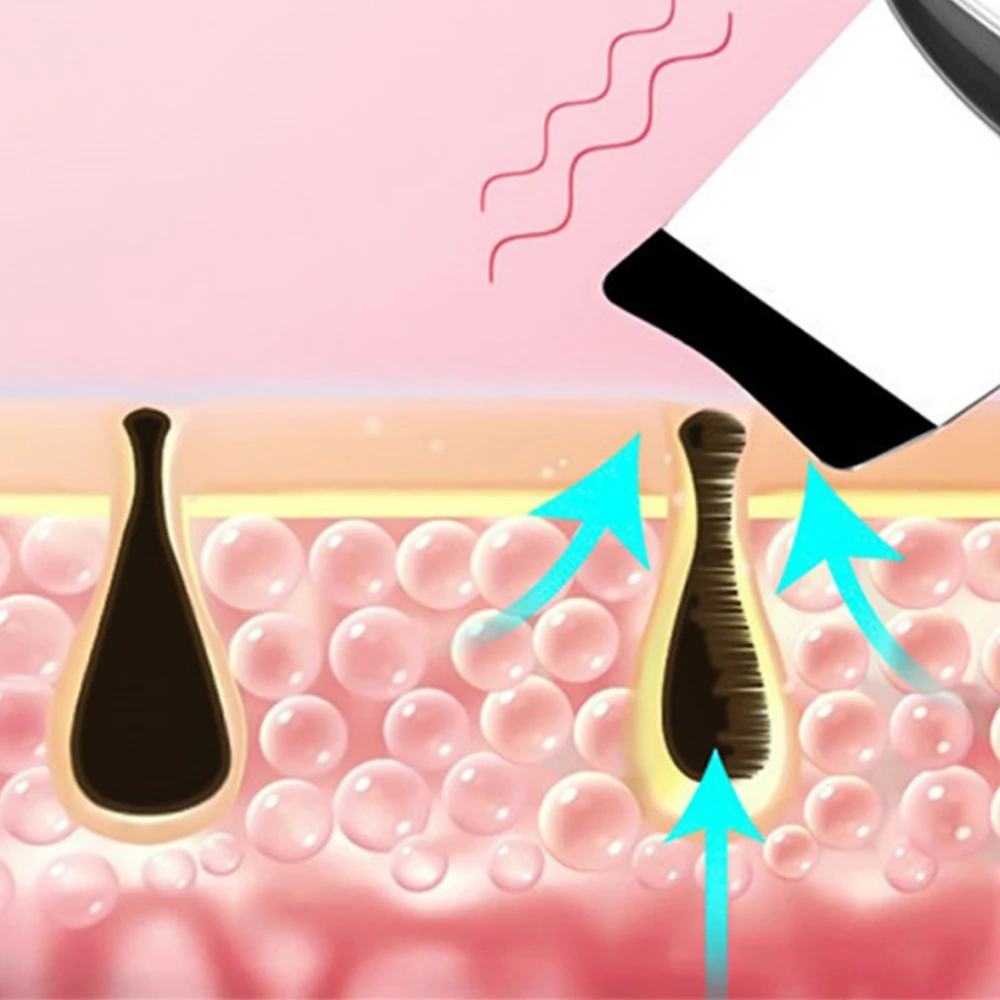 Limpador ultrassônico de pele, purificador facial, esfoliante, cuidados com a pele, acne, microcorrente, removedor de cravo, máquina de limpeza de poros faciais