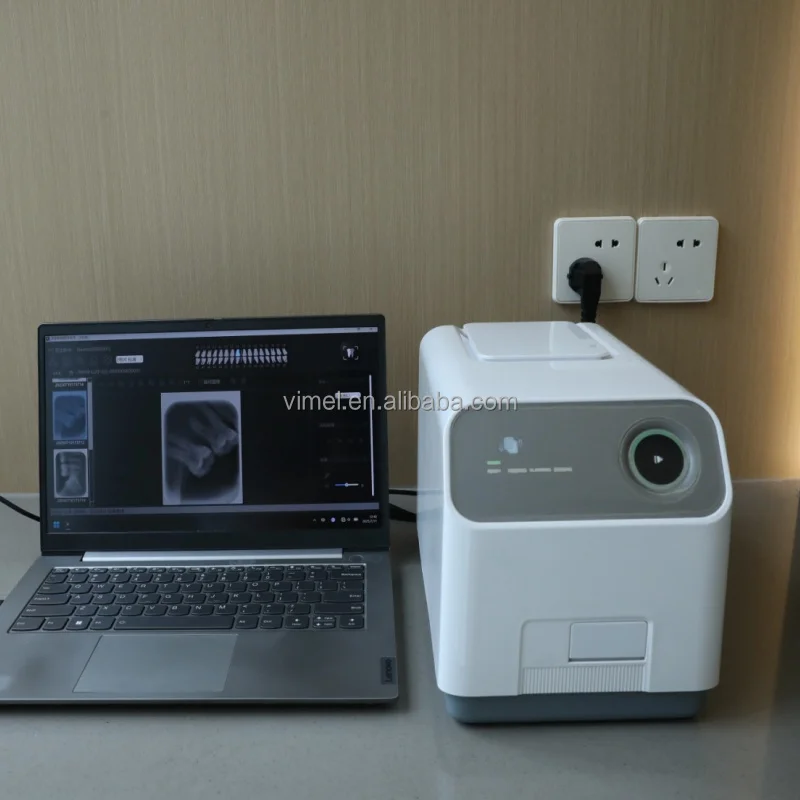 Portable Dental X Ray Machine Intraoral Digital Xray Imaging Phosphor Plate PSP Scanners High Definition Unit System