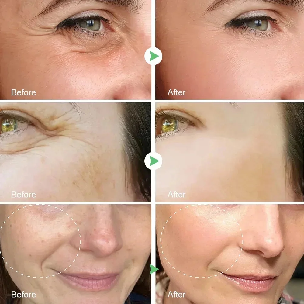 Bee Anti-Wrinkle Lift Face Cream Anti Aging Firming Effect Wrinkle Removal Skin Care Cream Nourish Moisturizing Beauty Products