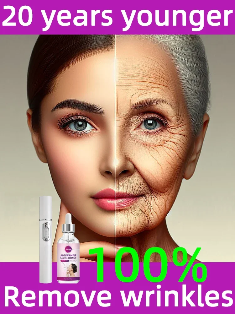 Solve all facial wrinkle problems