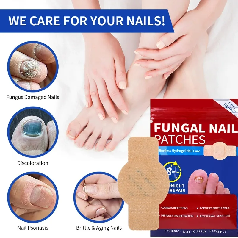 21-105pcs Fungo per unghie Patch Correzione incarnita impermeabile Toppe per unghie grigie danneggiate Adesivi per il trattamento dell'unghia del piede Strumento per la cura dei piedi