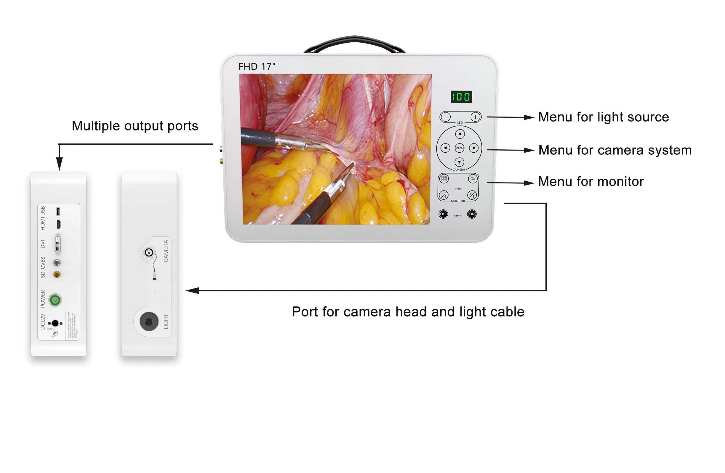 4 in 1 Portable Full HD Endoscopy Unit Surgical 17 Inch Medical Endoscope Camera System with LED Light Source laparoscopic