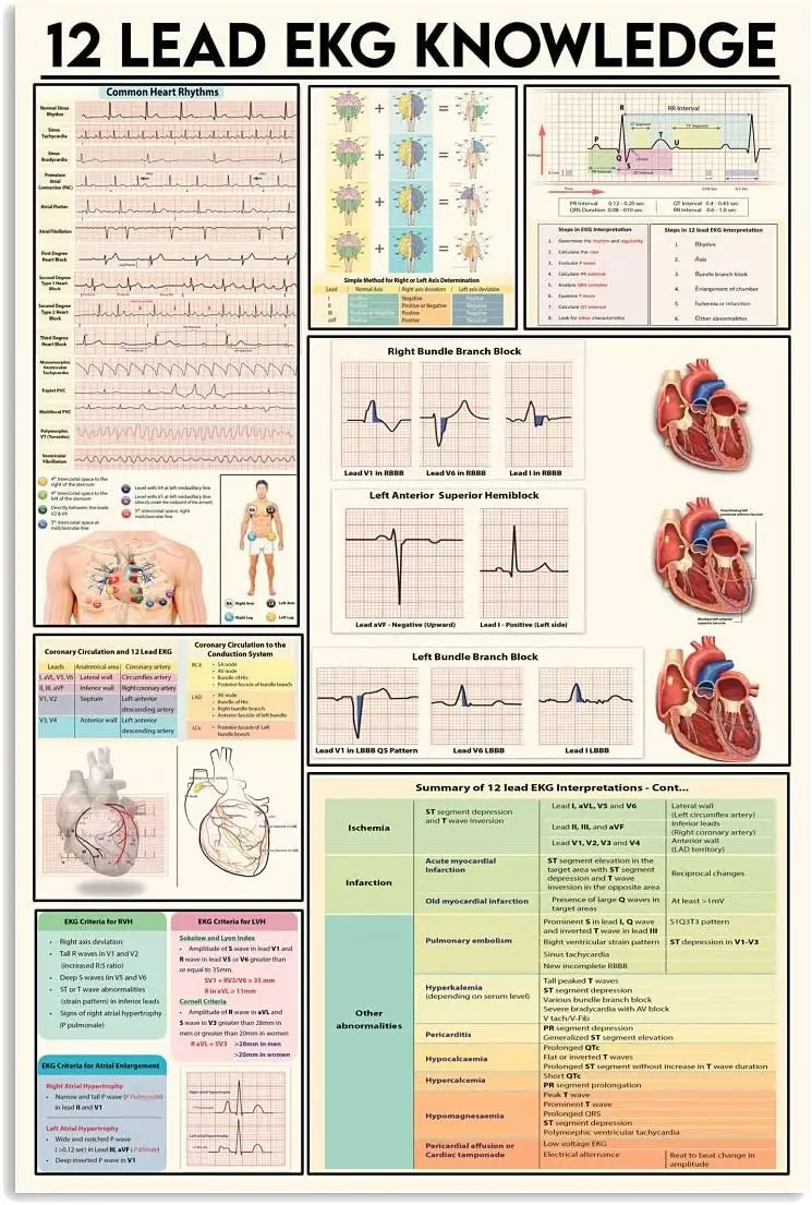 12 Read Ekg Knowledge Metal Signs Vintage Office Decor Doctor Science Guide Tin Poster Home Clinic Wall Decoration Plaque 8x12