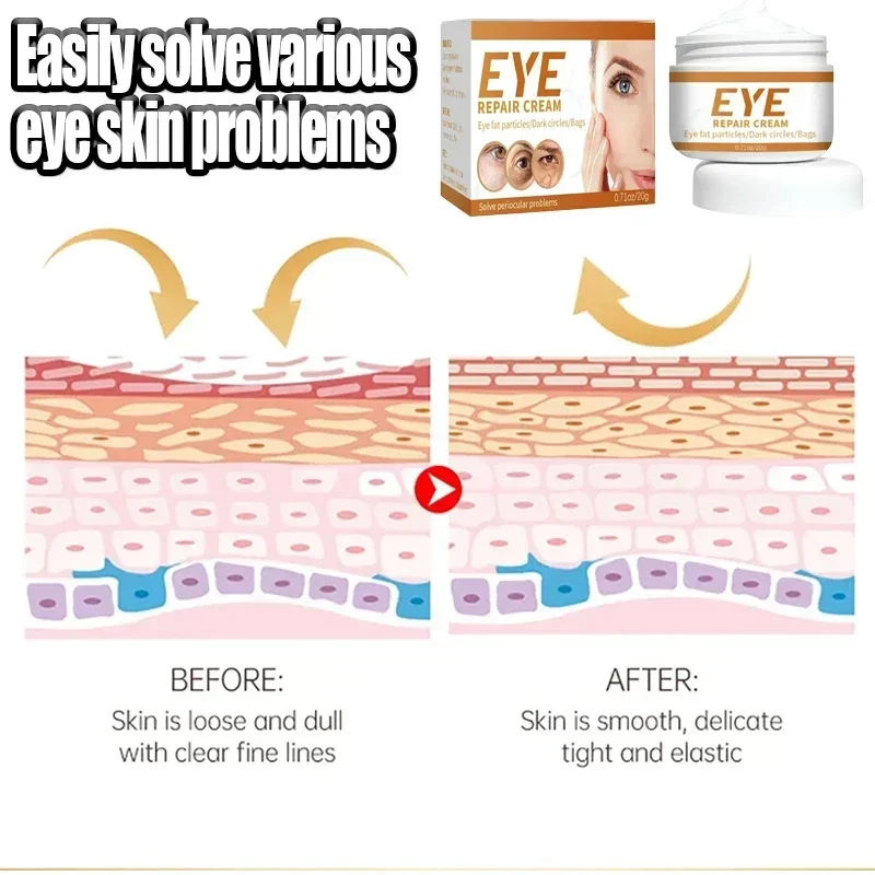 Instant Remove Wrinkle Cream Eye Bags Dark Circles Anti Puffiness Firm Cream Under Eyes Lightening Fine Lines Moisturizing