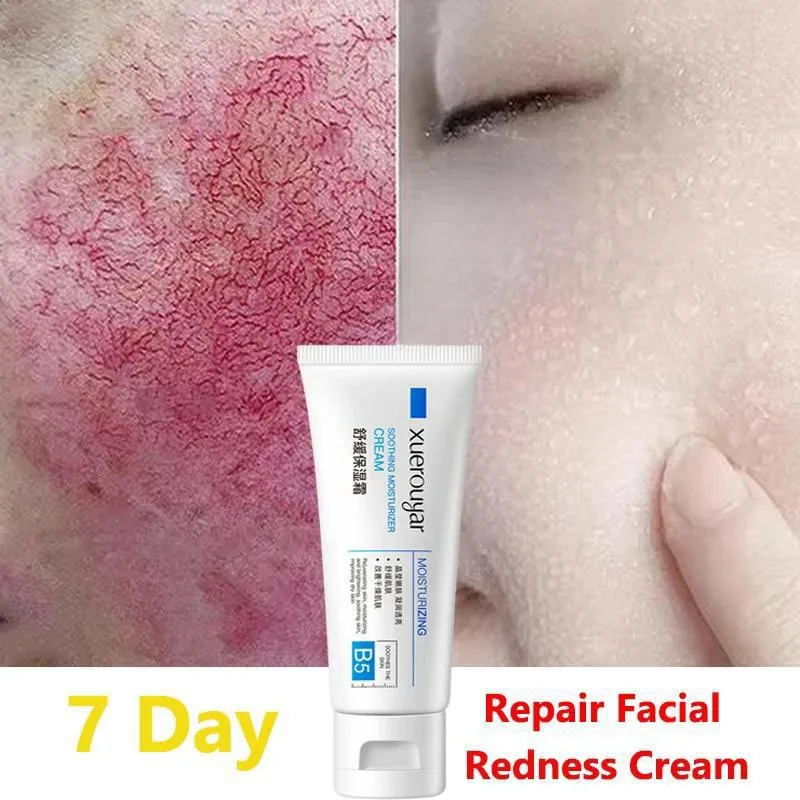 7 Tage Reparatur Gesichts rötung Creme beruhigende Rötung Reparatur Haut Rosacea rotes Blut verbessern empfindliche Hautpflege koreanische Kosmetik