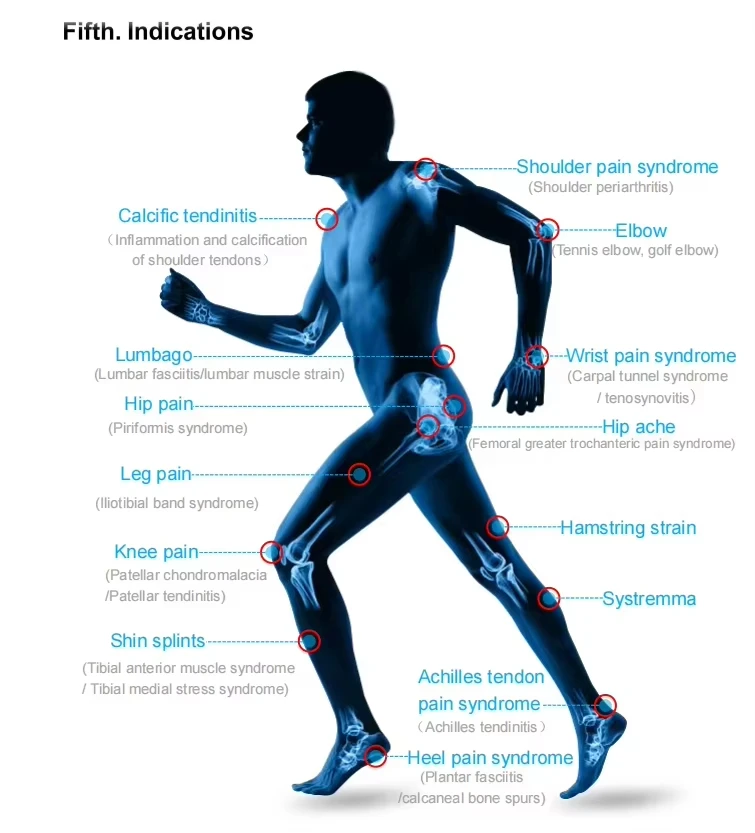 Focused Shockwave Portable Physical Therapy Machine Effective Pain Relief with ESWT Technology
