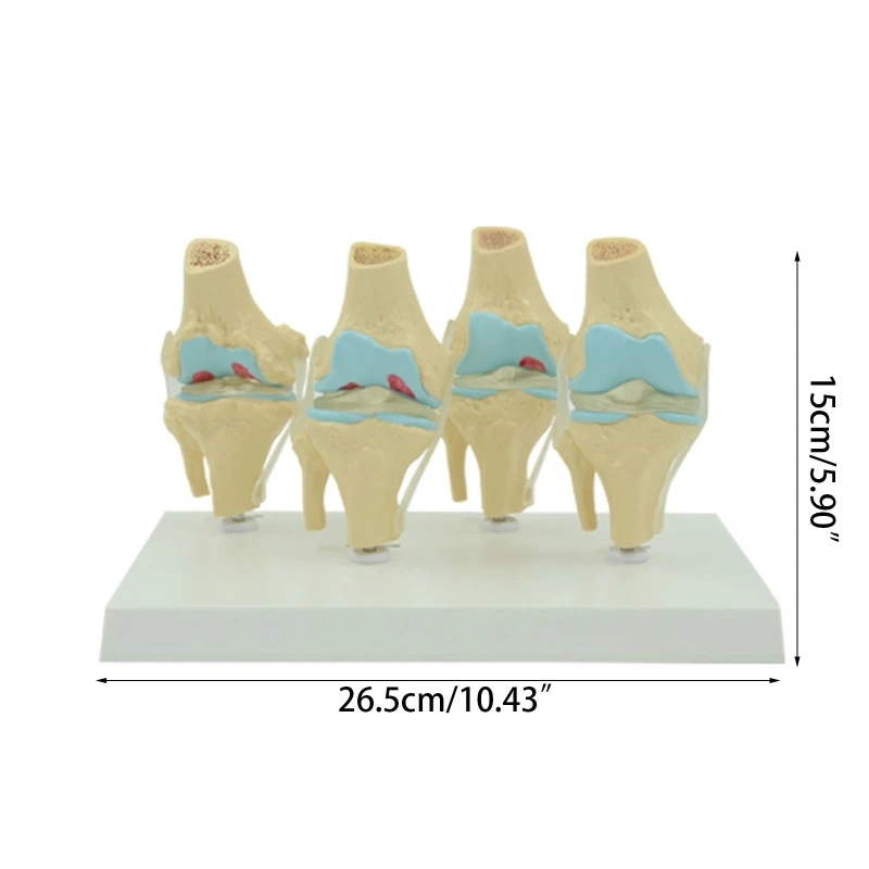 Flexible Human Knee Joint Anatomy Model Comparison of Knee Joint Model Scientific Life Size for