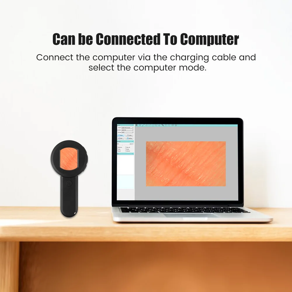 피부 분석을 위한 미니 충전식 휴대용 디지털 현미경 - 휴대용 8 LED 배율 피부경 및 피부 분석기