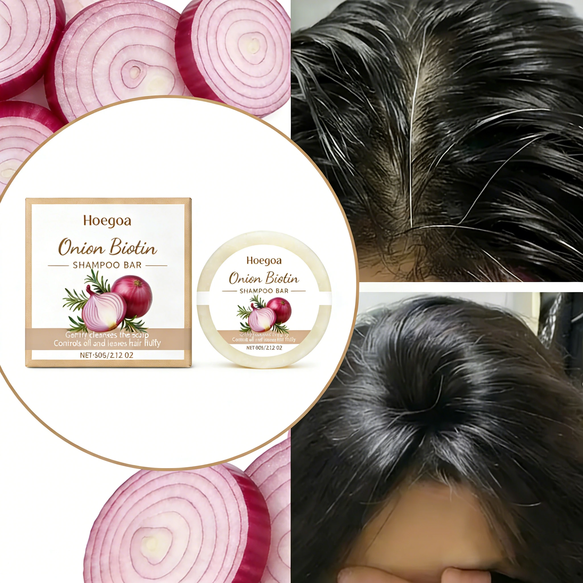 Barra de shampoo de biotina de cebola vermelha com extrato de alecrim suave anti-caspa controle de óleo refrescante limpeza do couro cabeludo barra de cuidados capilares